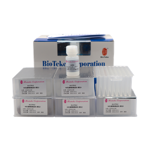 AU17011/17012 Pré -embalagem Viral DNA RNA Nucleic Acid Extração Kit (contas magnéticas)