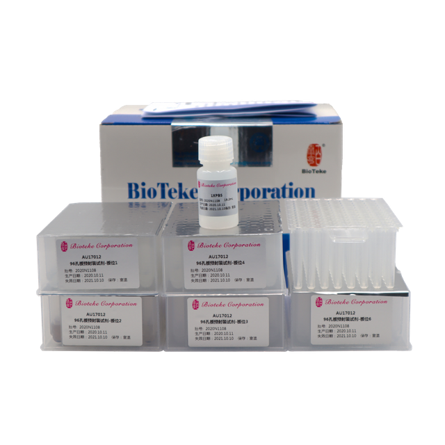 AU17011/17012 Pré -embalagem Viral DNA RNA Nucleic Acid Extração Kit (contas magnéticas)